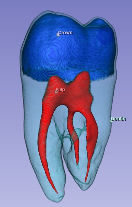 Tooth Segmentation