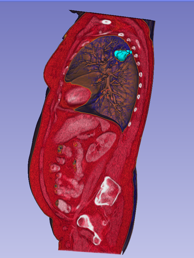 Direct visualisation of the abdomen