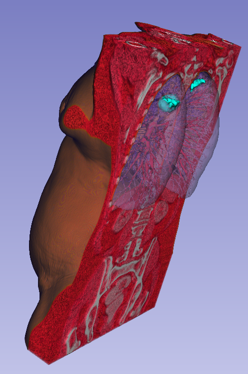 The volume of the lungs in anatomical context