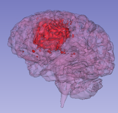 Direct PET visualisation