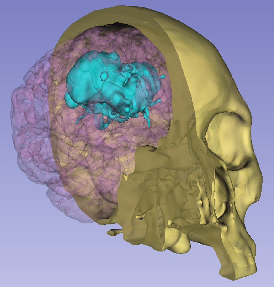 Sagittal view with brain segmentation