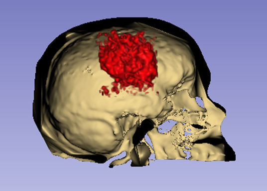 Sagittal view of angiogenesis