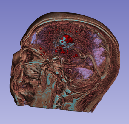 Sagittal direct visualisation