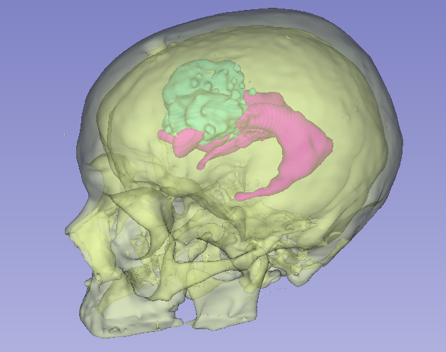 Sagittal view